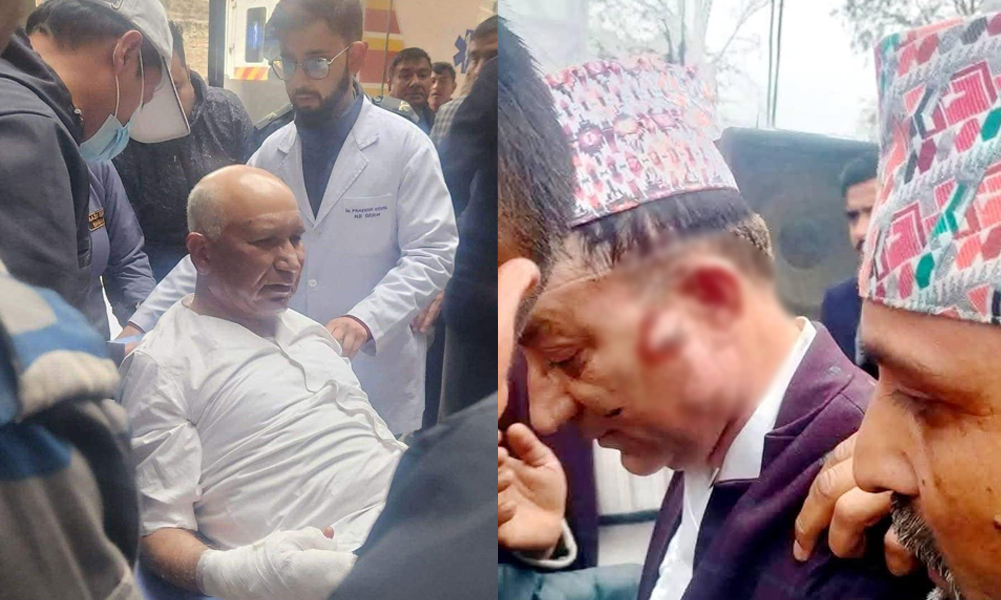 बेलुन पड्केर अर्थमन्त्री पौडेल र मेयर आचार्य घाइते, विशेष निगरानीमा भइरहेको छ उपचार